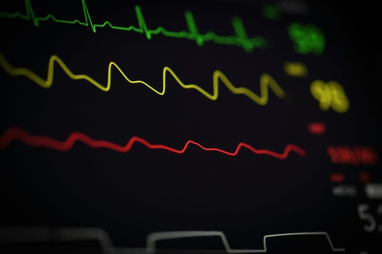 EKG-Kurve als Nahaufnahme auf schwarzem Monitor; abstrahierte Herzschlaglinie.
